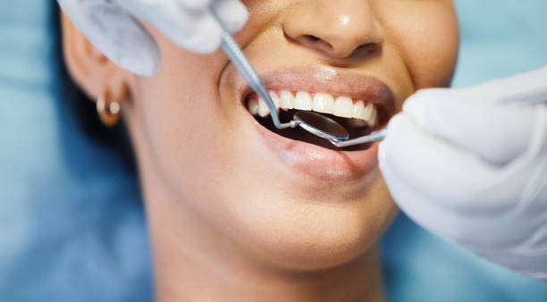 Best Emergency Dentist for Lost Fillings or Crowns in Millers Creek, NC
